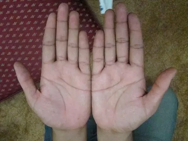 हथेली का कौन-सा तिल बदल सकता आपकी तकदीर, जानिए हथेली का कौन-सा तिल बदल सकता आपकी तकदीर, जानिए