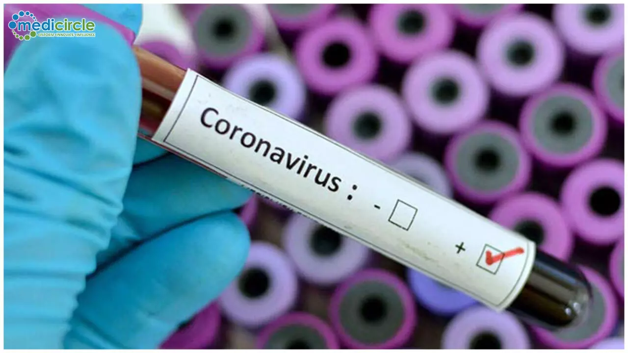 मुजफ्फनगर में आज मिले  97 कोरोना संक्रमित।