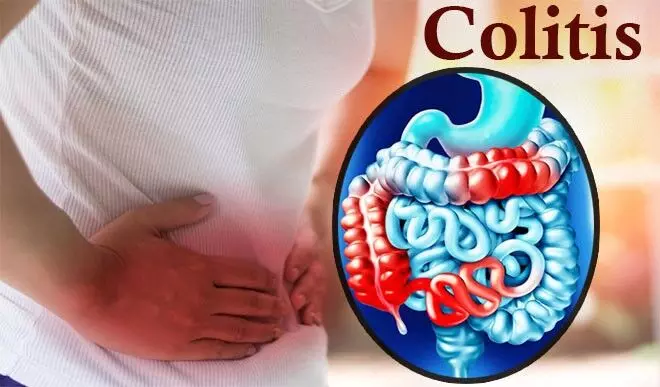 पेट की गंभीर बीमारी कोलाइटिस होने पर नजर आते हैं यह लक्षण