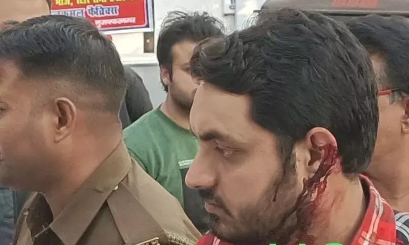 छात्रों के दो गुटों में चली गोलियां, कई घायल छात्रों के दो गुटों में चली गोलियां, कई घायल