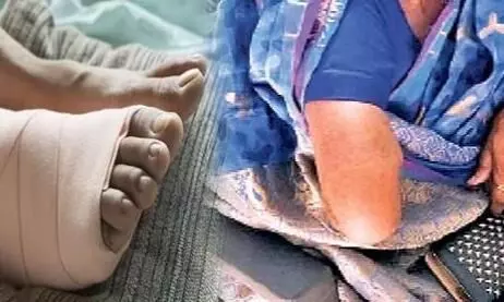 करना था पैर का ऑपरेशन, डॉक्टर ने काट दिया हाथ करना था पैर का ऑपरेशन, डॉक्टर ने काट दिया हाथ