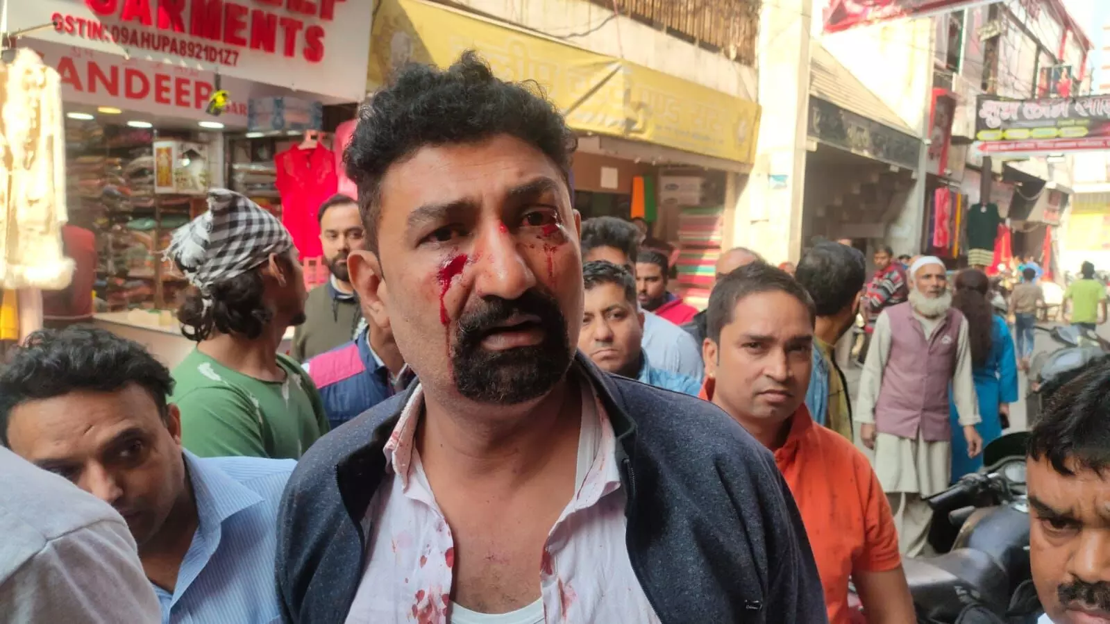 एसडी मार्केट में दुकान पर कब्जे को लेकर दो भाईयों के बीच मारपीट,अफरा-तफरी मची एसडी मार्केट में दुकान पर कब्जे को लेकर दो भाईयों के बीच मारपीट,अफरा-तफरी मची