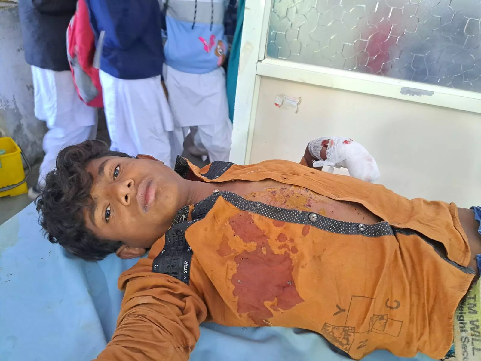 बालक के हाथ में मोबाइल फटा, छाती में आई गंभीर चोट बालक के हाथ में मोबाइल फटा, छाती में आई गंभीर चोट