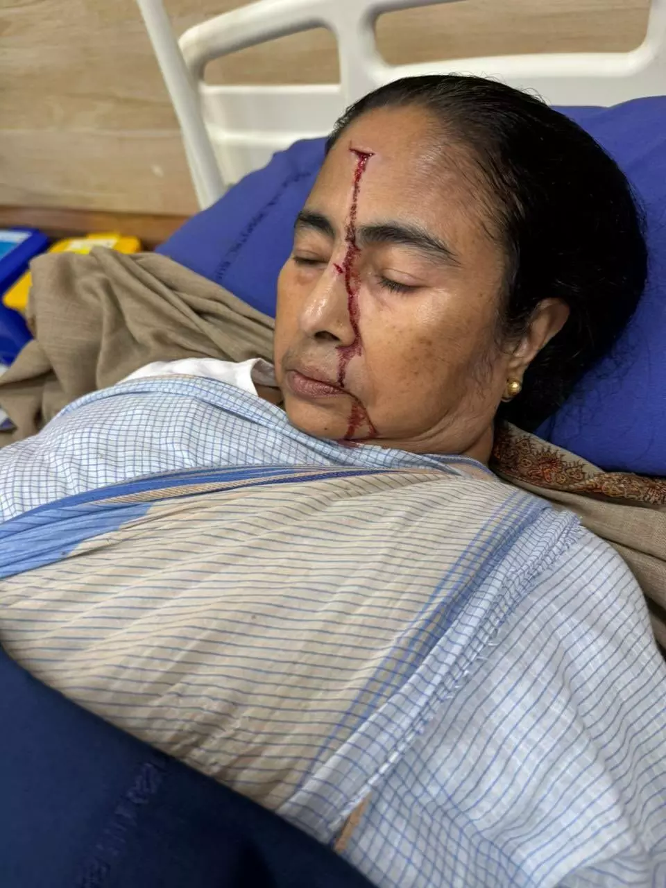 बंगाल की मुख्यमंत्री MamataBanerjee घायल हुईं, सिर पर लगी गंभीर चोट