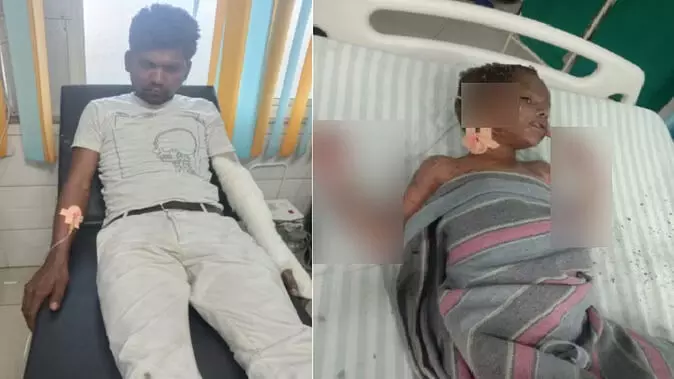 हिस्ट्रीशीटर जाॅनी के घर फटा मोबाइल, जलकर मर गये चार बच्चे, पत्नी गंभीर हिस्ट्रीशीटर जाॅनी के घर फटा मोबाइल, जलकर मर गये चार बच्चे, पत्नी गंभीर