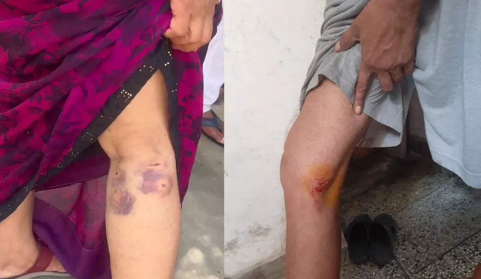 MUZAFFARNAGAR-ब्रह्मपुरी में आवारा कुत्तों का आतंक, नागरिकों में भय