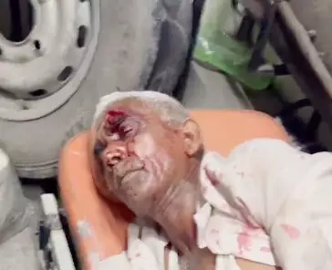 प्लाट के विवाद में खूनी संघर्ष, महिला सहित पांच घायल प्लाट के विवाद में खूनी संघर्ष, महिला सहित पांच घायल